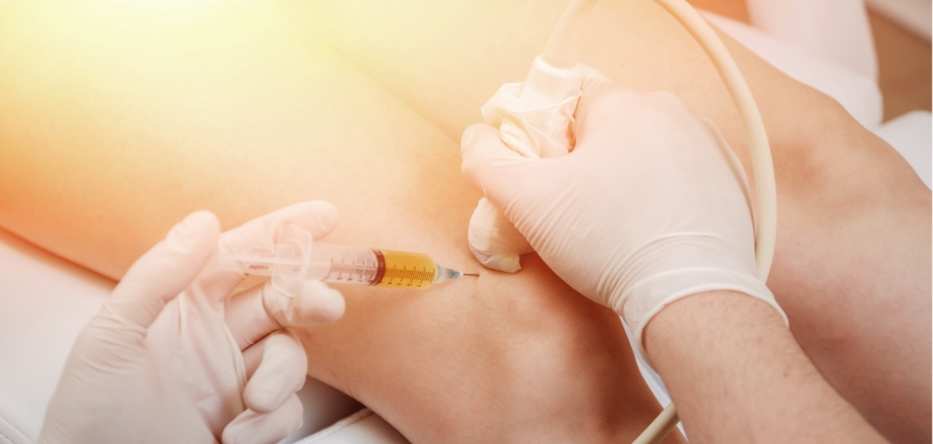 Ultrasound-guided platelet rich plasma injection