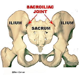 Sacroiliac Joint Disfunction