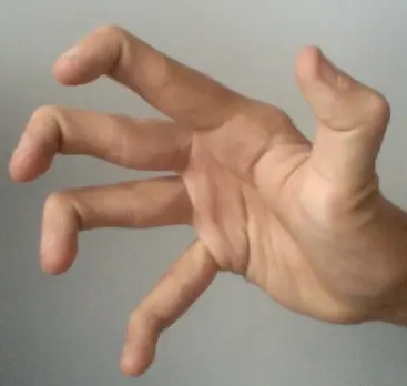Close-up of a hand with fingers bending dramatically backward and sideways, demonstrating extreme finger joint hypermobility