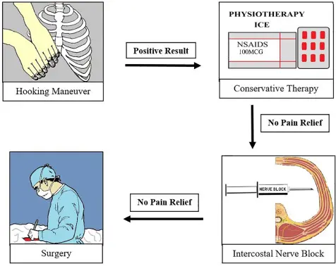 A flowchart illustrating the treatment pathway for slipping rib syndrome, progressing from a positive Hooking Maneuver through Conservative Therapy, to Intercostal Nerve Block, and finally to Surgery if pain relief is not achieved at each stage.