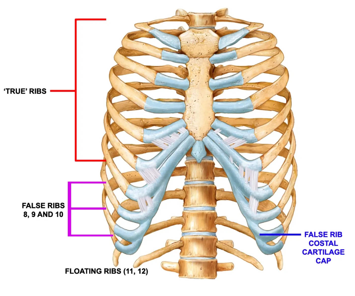 Anatomical diagram of the human rib cage viewed from the front, labeling the three rib types: "True" Ribs (upper seven pairs), False Ribs 8, 9, and 10, and Floating Ribs (11 and 12), along with the False Rib Costal Cartilage Cap.